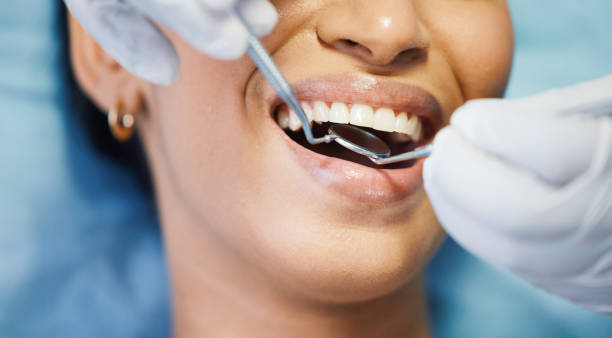 Best Same-Day Emergency Dental Services in Maywood Park, OR